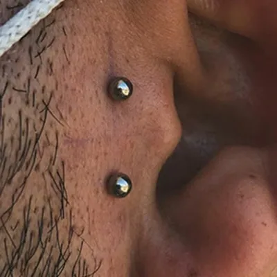 microdermal